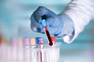 Multiple-sclerosis-blood-test-homepage.jpg