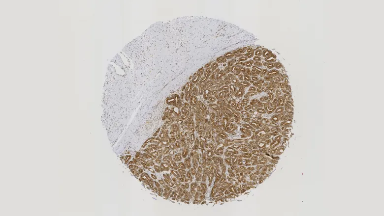 rna-binding-proteins-cancer.x4d810c00.webp